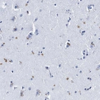 Anti-LRRC8E Antibody