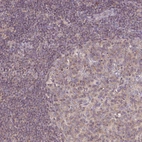 Immunohistochemical staining of human lymph node shows weak cytoplasmic positivity in lymphoid cells.