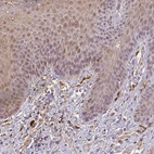 Immunohistochemical staining of human skin shows weak cytoplasmic positivity in squamous epithelial cells.