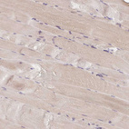 Immunohistochemical staining of human skeletal muscle shows very weak cytoplasmic positivity in myocytes.