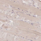 Immunohistochemical staining of human skeletal muscle shows very weak cytoplasmic positivity in myocytes.