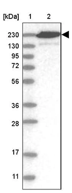 Lane 1: Marker [kDa] 230, 130, 95, 72, 56, 36, 28, 17, 11_br/_Lane 2: Human cell line RT-4
