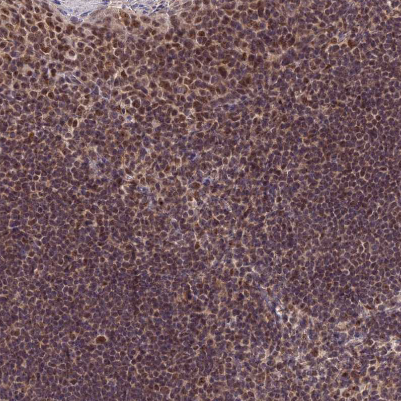 Anti-EXOSC3 Antibody