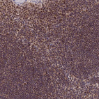 Anti-EXOSC3 Antibody