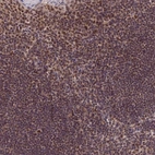 Anti-EXOSC3 Antibody