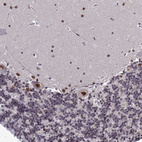 Immunohistochemical staining of human cerebellum shows strong nuclear positivity in Purkinje cells.