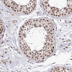 Immunohistochemical staining of human testis shows strong nuclear positivity in cells in seminiferous ducts.