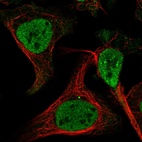 Immunofluorescent staining of human cell line U-2 OS shows localization to nucleoplasm.