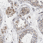 Anti-MALSU1 Antibody