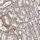 Immunohistochemical staining of human kidney shows strong granular cytoplasmic positivity in cells in tubules.
