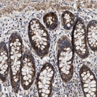 Immunohistochemical staining of human rectum shows strong granular cytoplasmic positivity in glandular cells.
