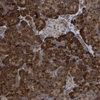 Immunohistochemical staining of human pancreas shows strong granular cytoplasmic positivity in exocrine glandular cells.