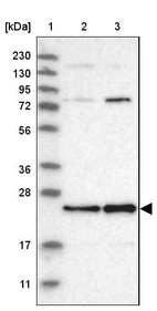 Lane 1: Marker [kDa] 230, 130, 95, 72, 56, 36, 28, 17, 11_br/_Lane 2: Human cell line RT-4_br/_Lane 3: Human cell line U-251MG sp