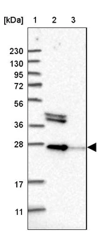 Lane 1: Marker [kDa] 230, 130, 95, 72, 56, 36, 28, 17, 11_br/_Lane 2: Human cell line RT-4_br/_Lane 3: Human cell line U-251MG sp