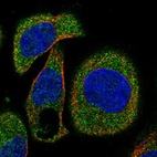 Immunofluorescent staining of human cell line A-431 shows localization to cytosol.
