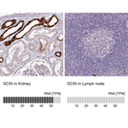 Anti-SCIN Antibody