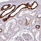 Immunohistochemical staining of human kidney shows high expression.