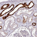 Immunohistochemical staining of human kidney shows high expression.