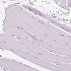 Immunohistochemical staining of human skeletal muscle shows no positivity in myocytes as expected.