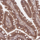 Immunohistochemical staining of human small intestine shows moderate granular cytoplasmic positivity in glandular cells.