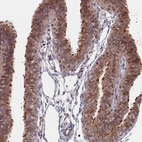 Immunohistochemical staining of human fallopian tube shows moderate cytoplasmic positivity in glandular cells.