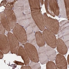 Immunohistochemical staining of human skeletal muscle shows moderate cytoplasmic positivity in myocytes.