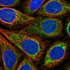 Immunofluorescent staining of human cell line SiHa shows localization to mitochondria.
