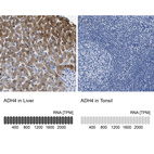 Anti-ADH4 Antibody