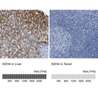 Anti-ADH4 Antibody