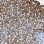 Anti-ADH4 Antibody