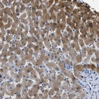 Immunohistochemical staining of human liver shows strong cytoplasmic positivity in hepatocytes.