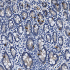 Immunohistochemical staining of human duodenum shows strong cytoplasmic positivity in endocrine glandular cells.