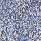 Anti-ADH4 Antibody