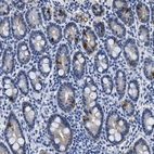 Immunohistochemical staining of human duodenum shows strong cytoplasmic positivity in endocrine glandular cells.