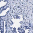Immunohistochemical staining of human fallopian tube shows no positivity in glandular cells as expected.
