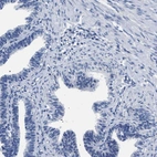 Immunohistochemical staining of human fallopian tube shows no positivity in glandular cells as expected.