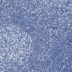 Immunohistochemical staining of human tonsil shows no positivity in germinal center cells as expected.