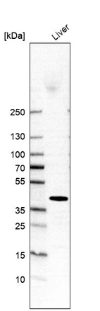 Western blot analysis in human liver tissue.