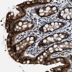 Anti-NSUN5 Antibody