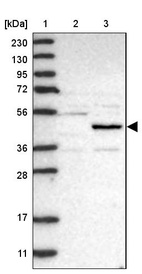 Lane 1: Marker [kDa] 230, 130, 95, 72, 56, 36, 28, 17, 11_br/_Lane 2: Human cell line RT-4_br/_Lane 3: Human cell line U-251MG sp