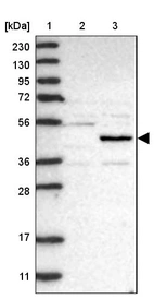 Lane 1: Marker [kDa] 230, 130, 95, 72, 56, 36, 28, 17, 11_br/_Lane 2: Human cell line RT-4_br/_Lane 3: Human cell line U-251MG sp
