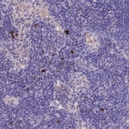 Anti-ASAP3 Antibody