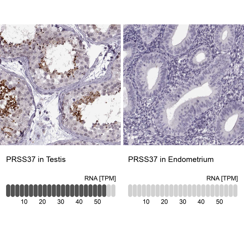 Anti-PRSS37 Antibody