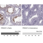 Anti-PRSS37 Antibody
