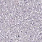 Anti-PRSS37 Antibody