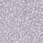 Immunohistochemical staining of human liver shows no positivity in hepatocytes as expected.