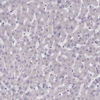Immunohistochemical staining of human liver shows no positivity in hepatocytes as expected.