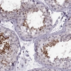Immunohistochemical staining of human testis shows strong cytoplasmic positivity in cells in seminiferous ducts.