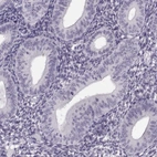 Immunohistochemical staining of human endometrium shows no positivity in glandular cells as expected.