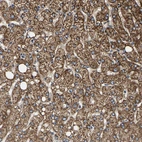 Immunohistochemical staining of human liver shows moderate granular cytoplasmic positivity in hepatocytes.